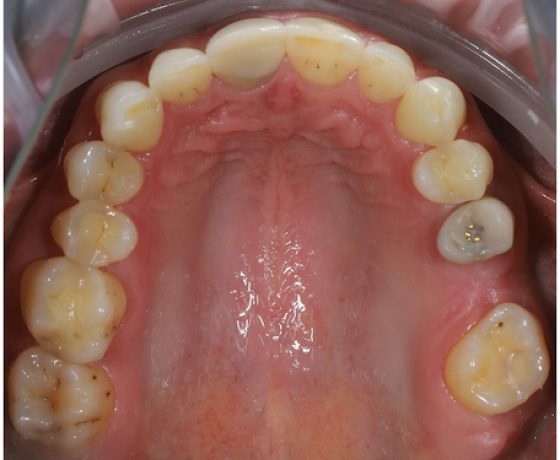 photo-1