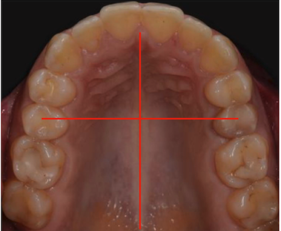 photo-2